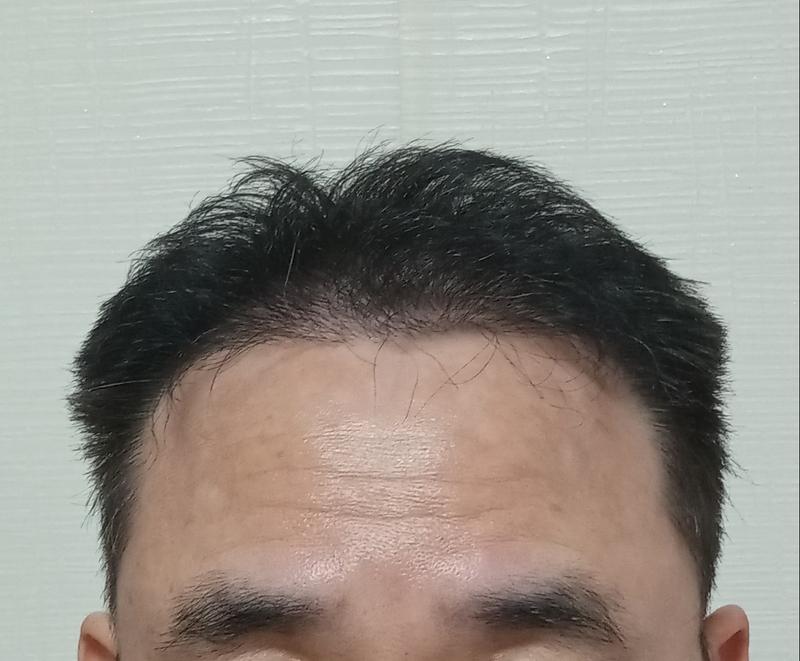 母材性8ヶ月目です。