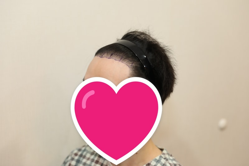 전2 2.jpg