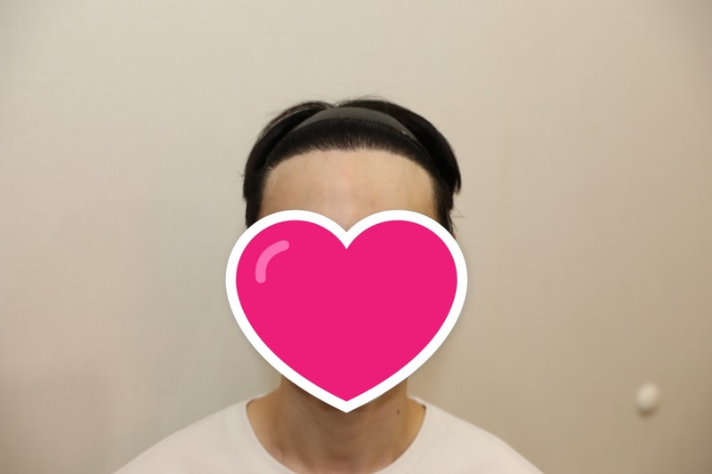 후1.jpg