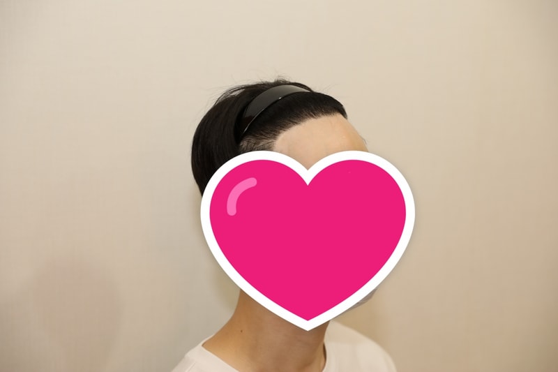 후5.jpg