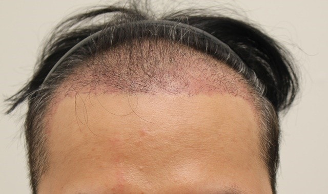 I've been having gray hair lately..