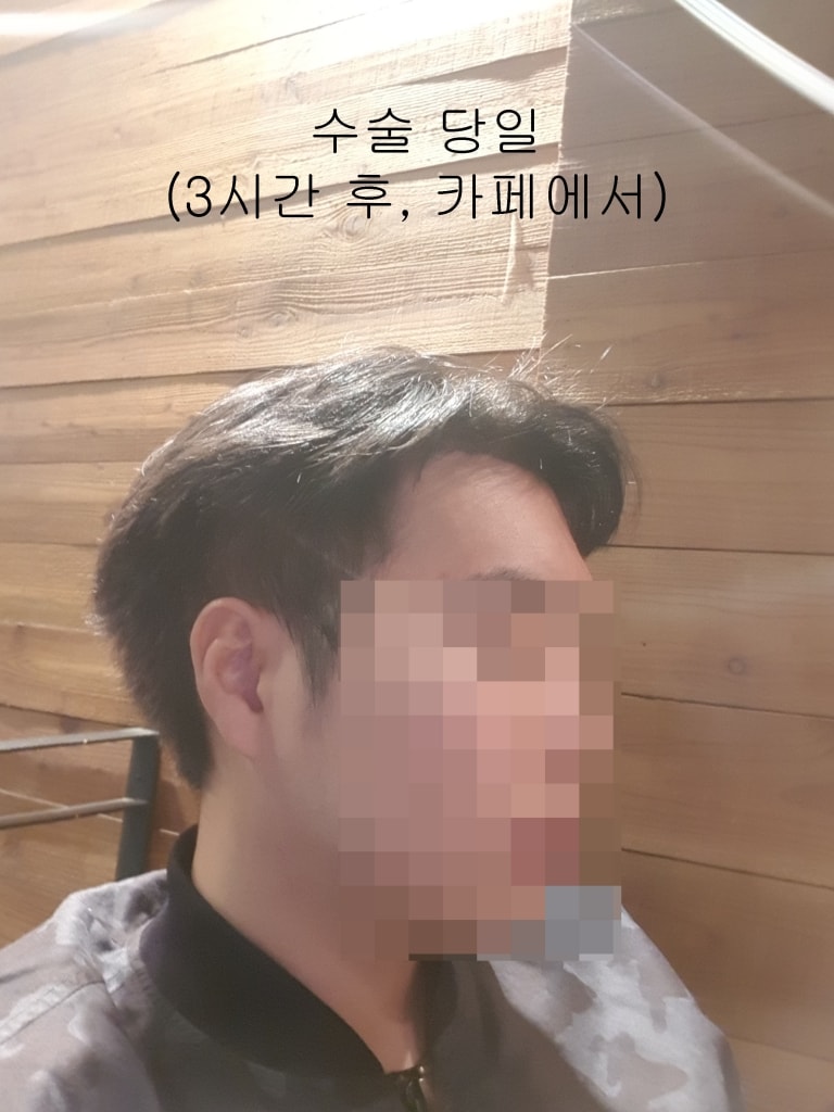 수술당일3.jpg