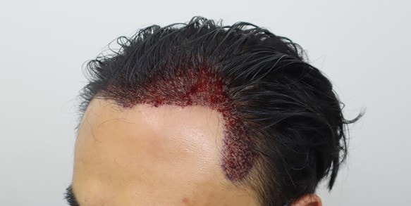 수술후0우.jpg
