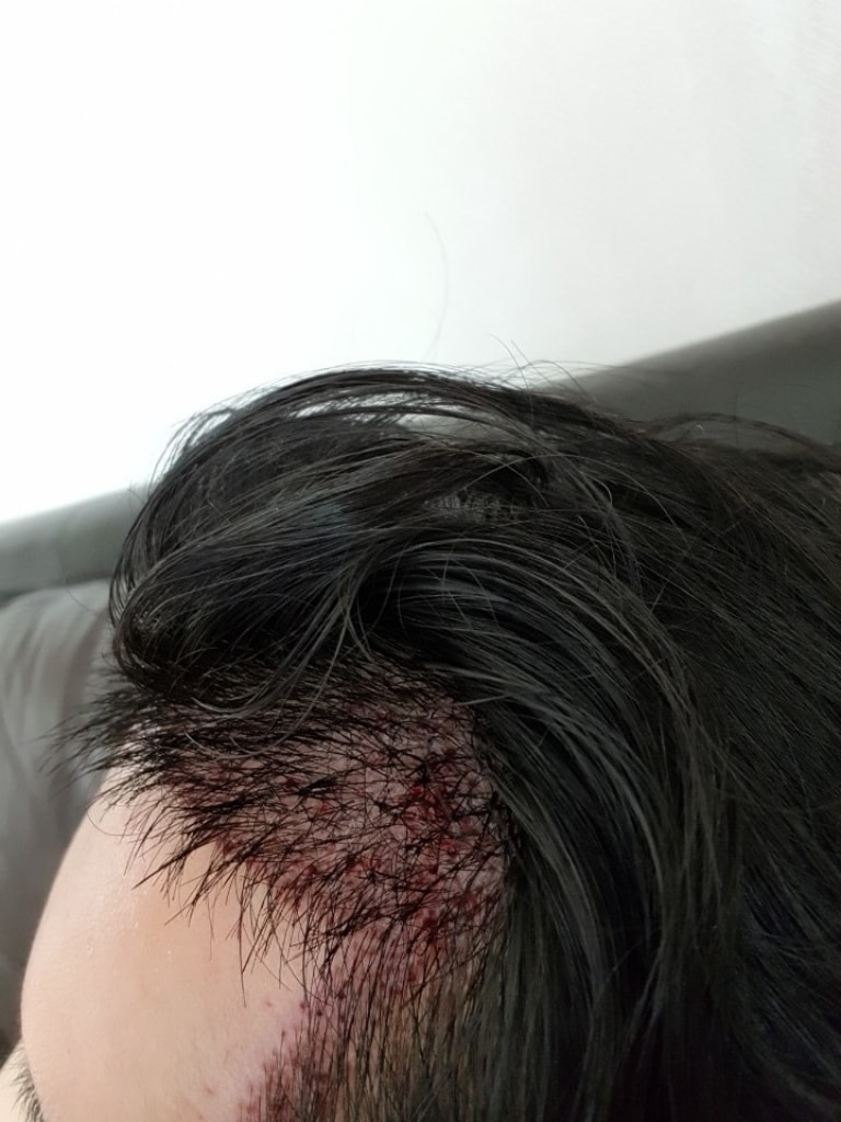 오.jpg