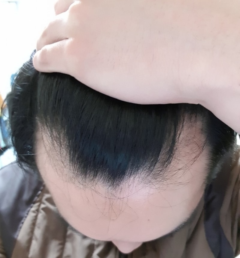 전.jpg