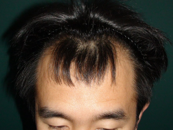 성,술전,정면,s.jpg