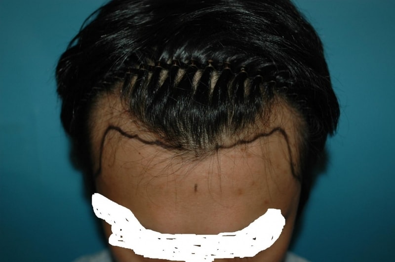 윗면.JPG