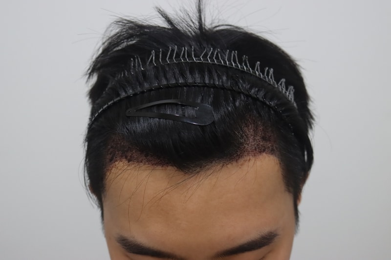 샴푸4.jpg