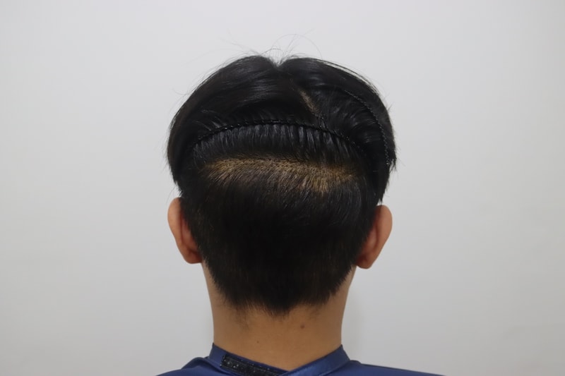 후두부1.jpg