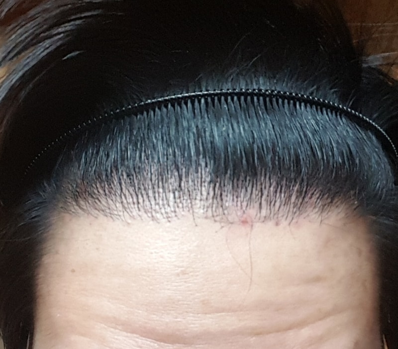 20180306_221420.jpg