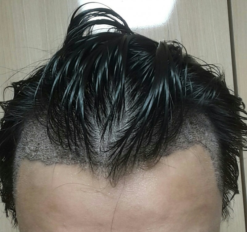 후.정면2.jpg