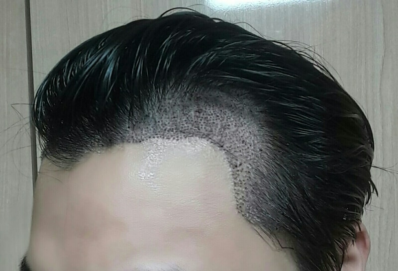 후.오른쪽.jpg