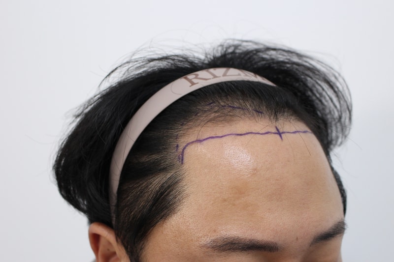 수술전2.jpg
