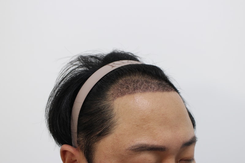 2주후.jpg