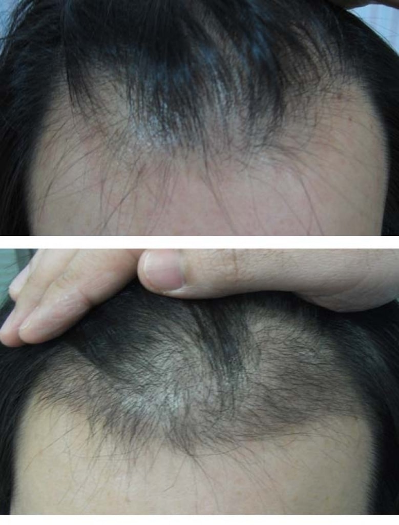 hairtr.jpg