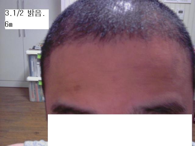 3.밝음6미리.JPG