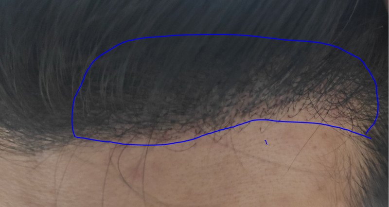 10일차 오른쪽.PNG