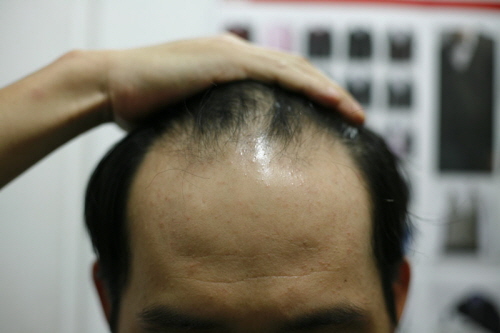 크기변환_머리1.JPG