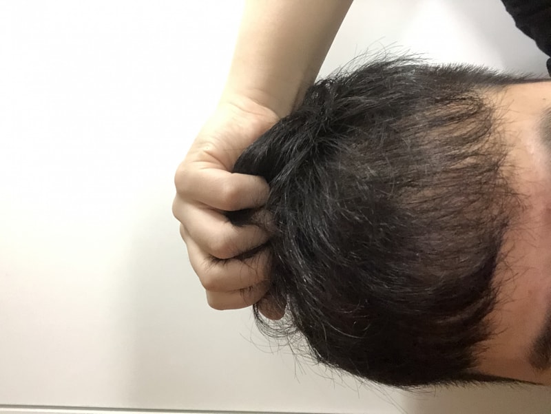 머리2.jpeg