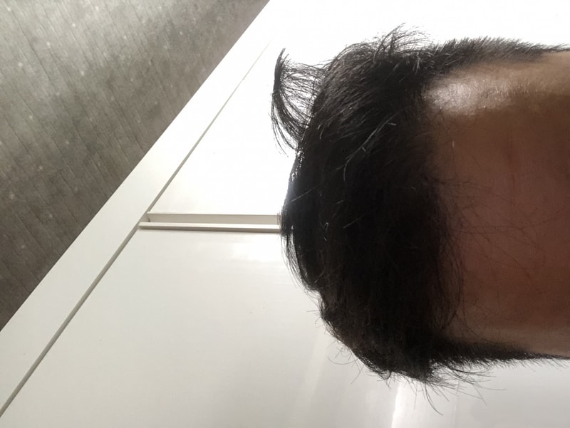 머리3.jpeg