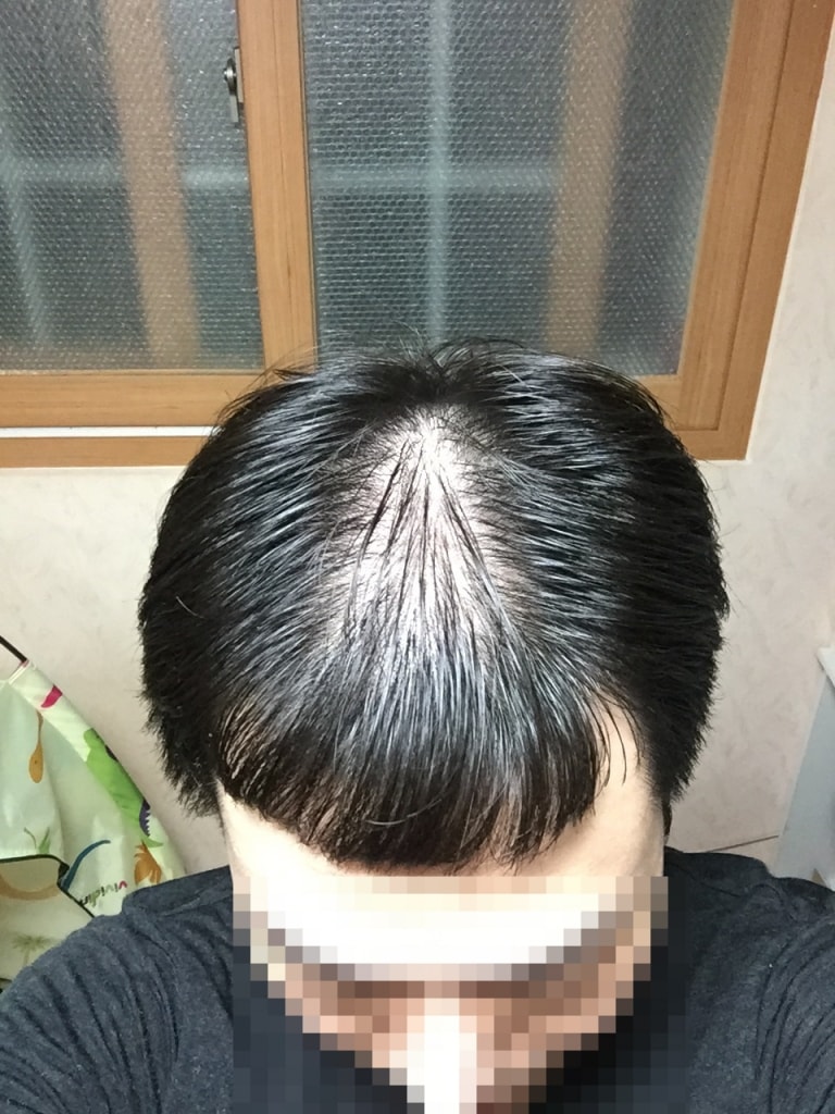 수술전.jpg