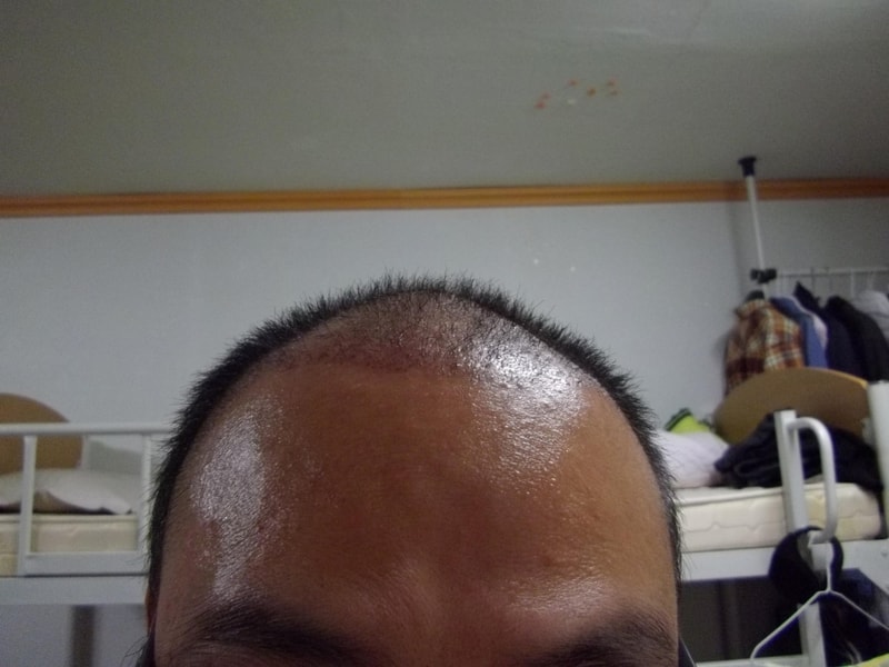 이마.JPG
