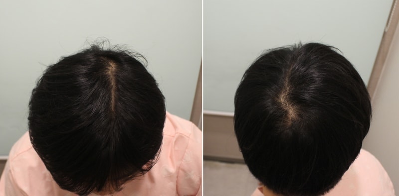 포토후기 이미지