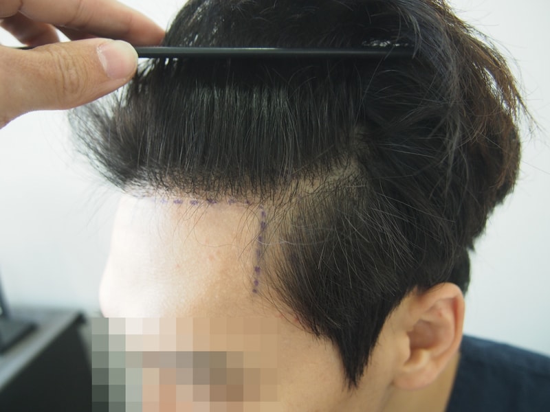 전_좌측.JPG