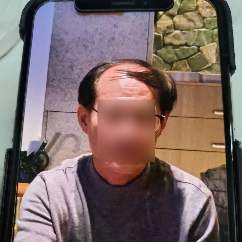 수술전 1.jpg