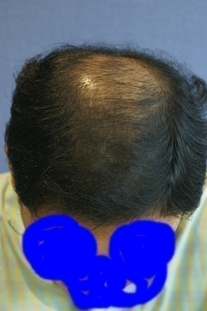 1.JPG