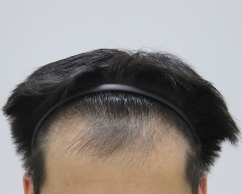 This is a post-mortem photo after 7 months.