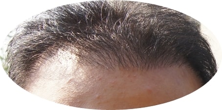 수술전.JPG