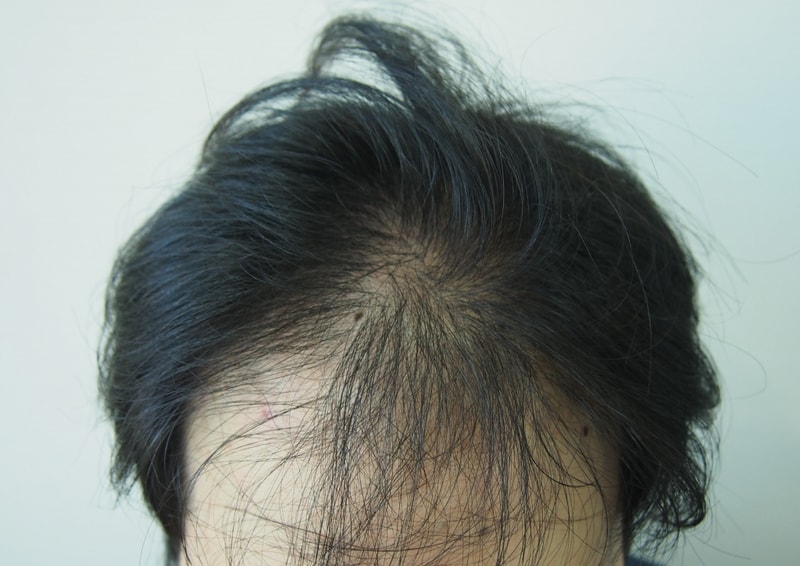 늦은 후기