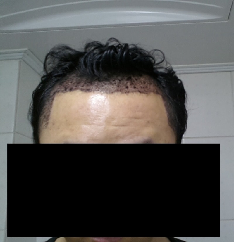 후2정면.jpg