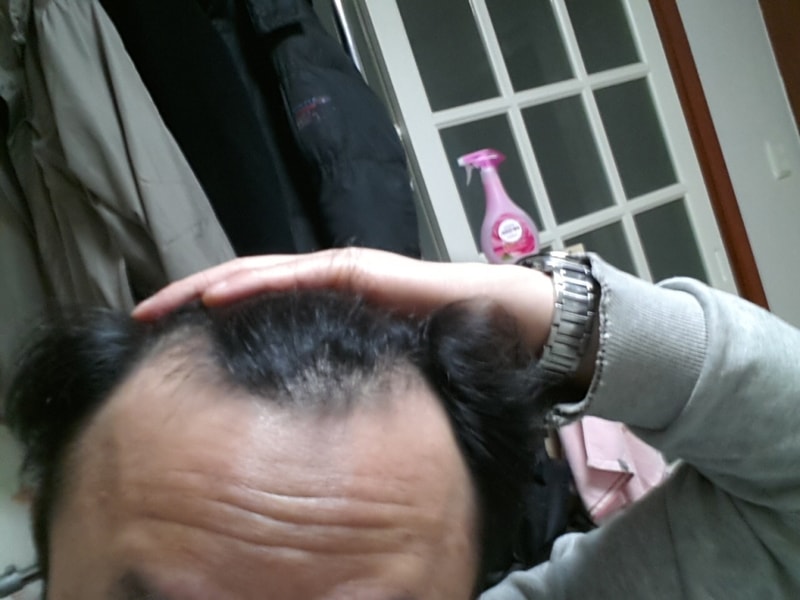 전2정면.jpg