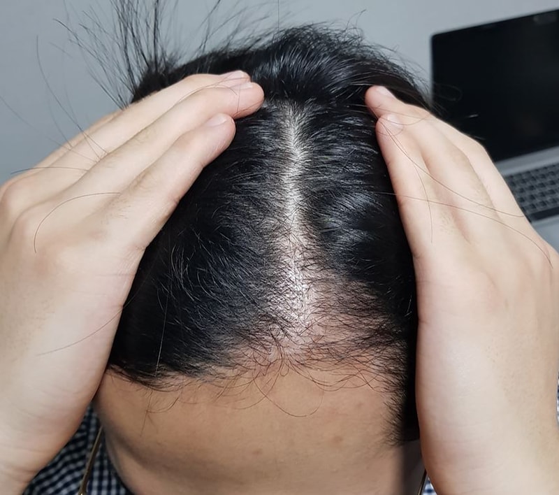 좌가르마.JPG
