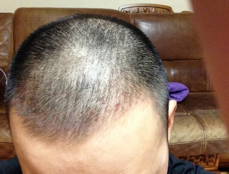 I'm posting a review of the 110th day of Daegu's forehair.