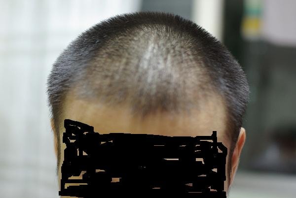 1개월1.JPG