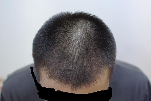 2개월2.JPG
