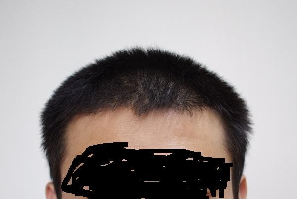 4개월1.JPG