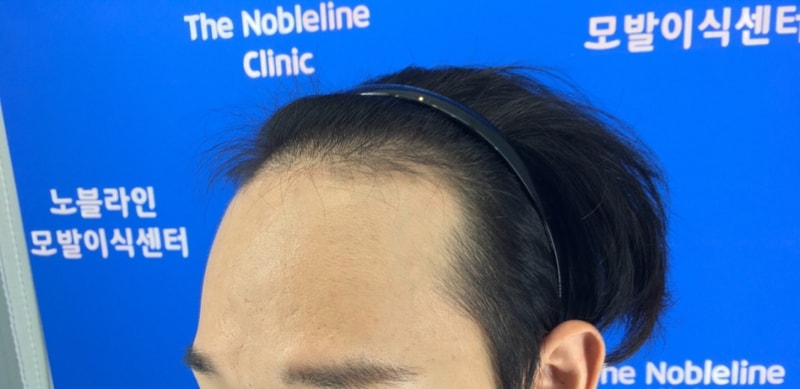 -KakaoTalk_20190802_161827859.jpg