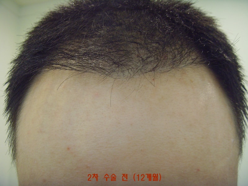 꾸미기_SNV32418.JPG