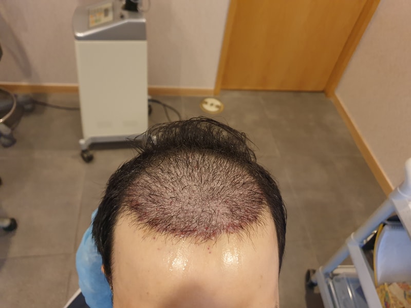 수술후- 정.jpg