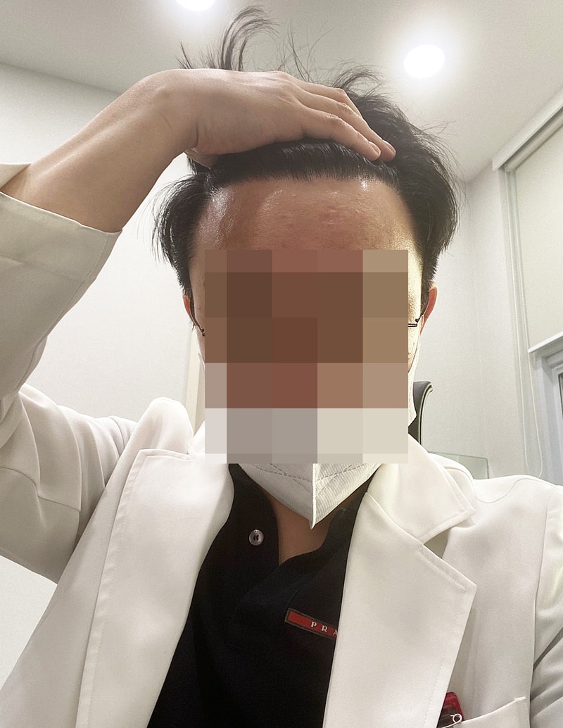 7. 수술 후 1년.jpg
