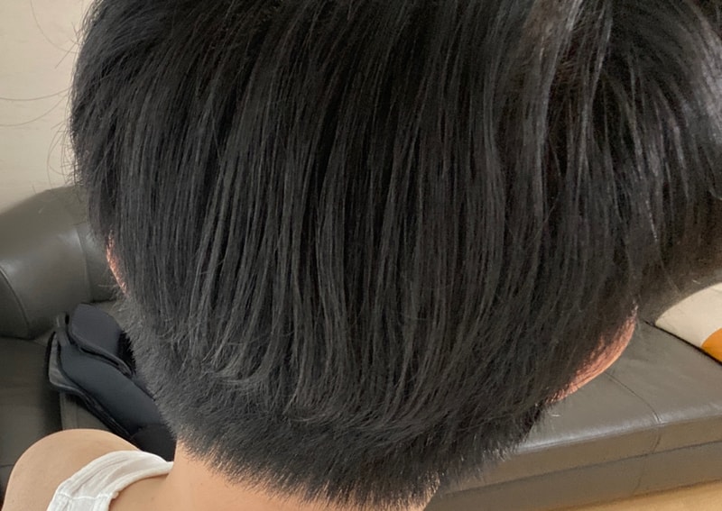 2. 수술 다음날 2.jpg