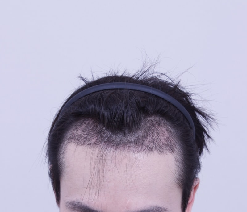 3주.JPG