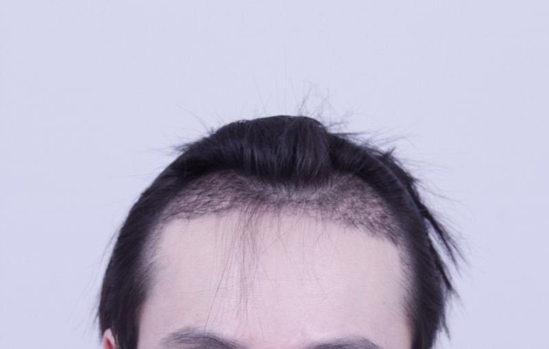 3주1.JPG