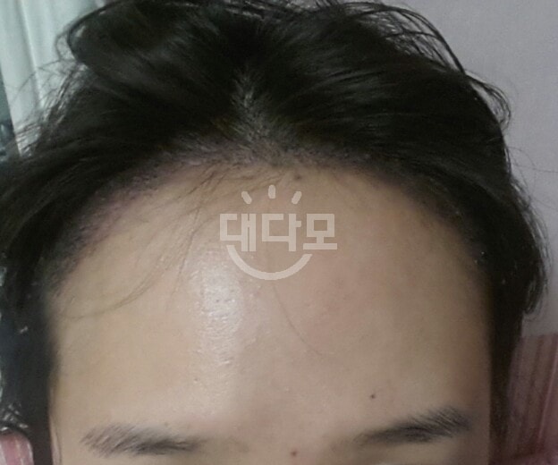 후1.jpg