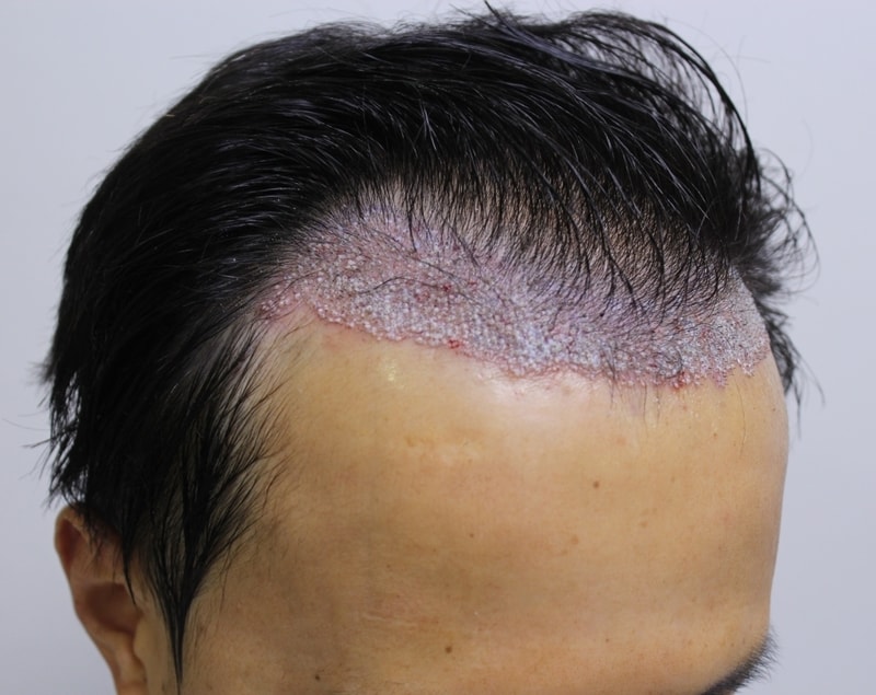 수술후2.JPG