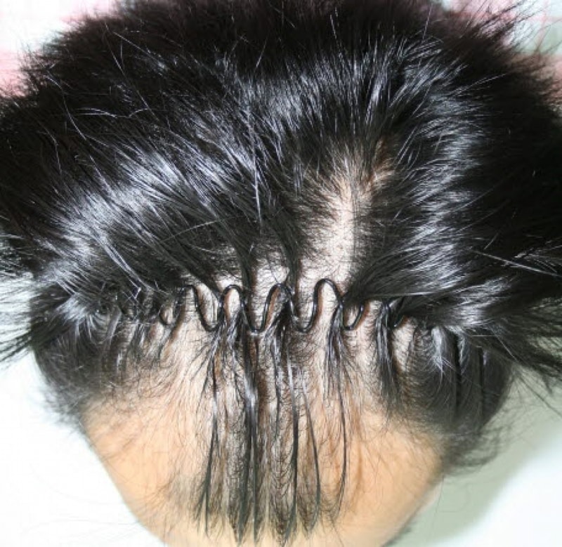 I'm going to post a review of my forehair only today.